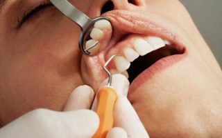 How to Beat Dental Anxiety: Easy Guide