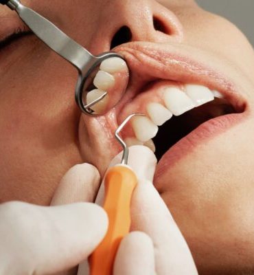 How to Beat Dental Anxiety: Easy Guide