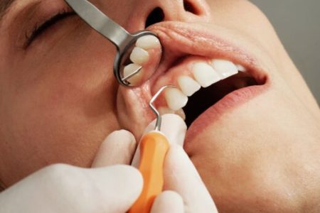 How to Beat Dental Anxiety: Easy Guide