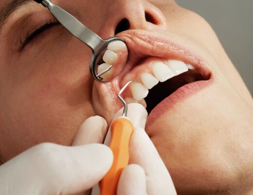 How to Beat Dental Anxiety: Easy Guide