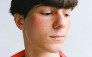 Hormonal Acne On Chin Treatment: Chin Acne Treatment: The Step-by-Step Fix for Hormonal Breakouts