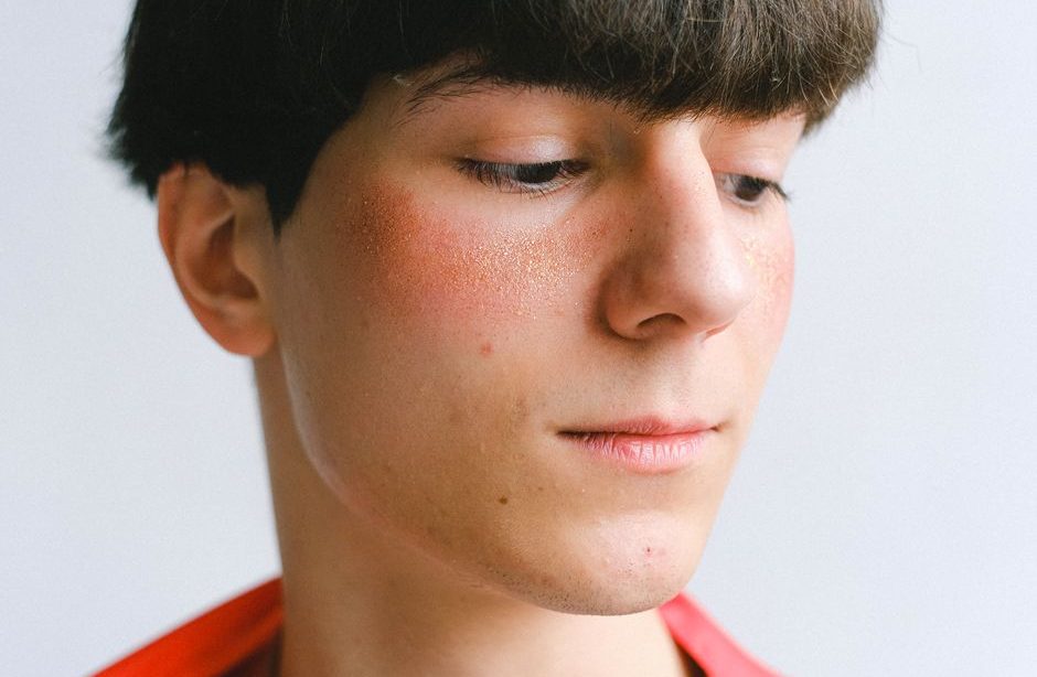 Hormonal Acne On Chin Treatment: Chin Acne Treatment: The Step-by-Step Fix for Hormonal Breakouts