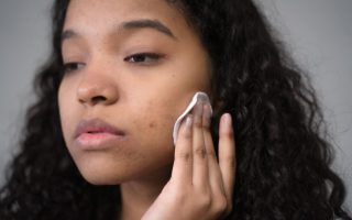 How I Finally Got Rid of Hormonal Chin Acne Without Prescription Meds