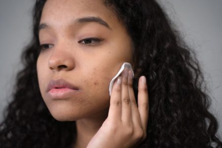 How I Finally Got Rid of Hormonal Chin Acne Without Prescription Meds